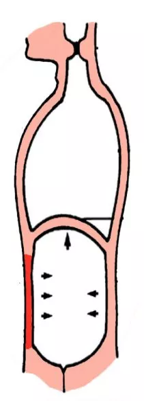 Lichaam