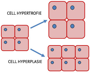 hypertrofie-theorie