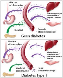 diabetes uitleg