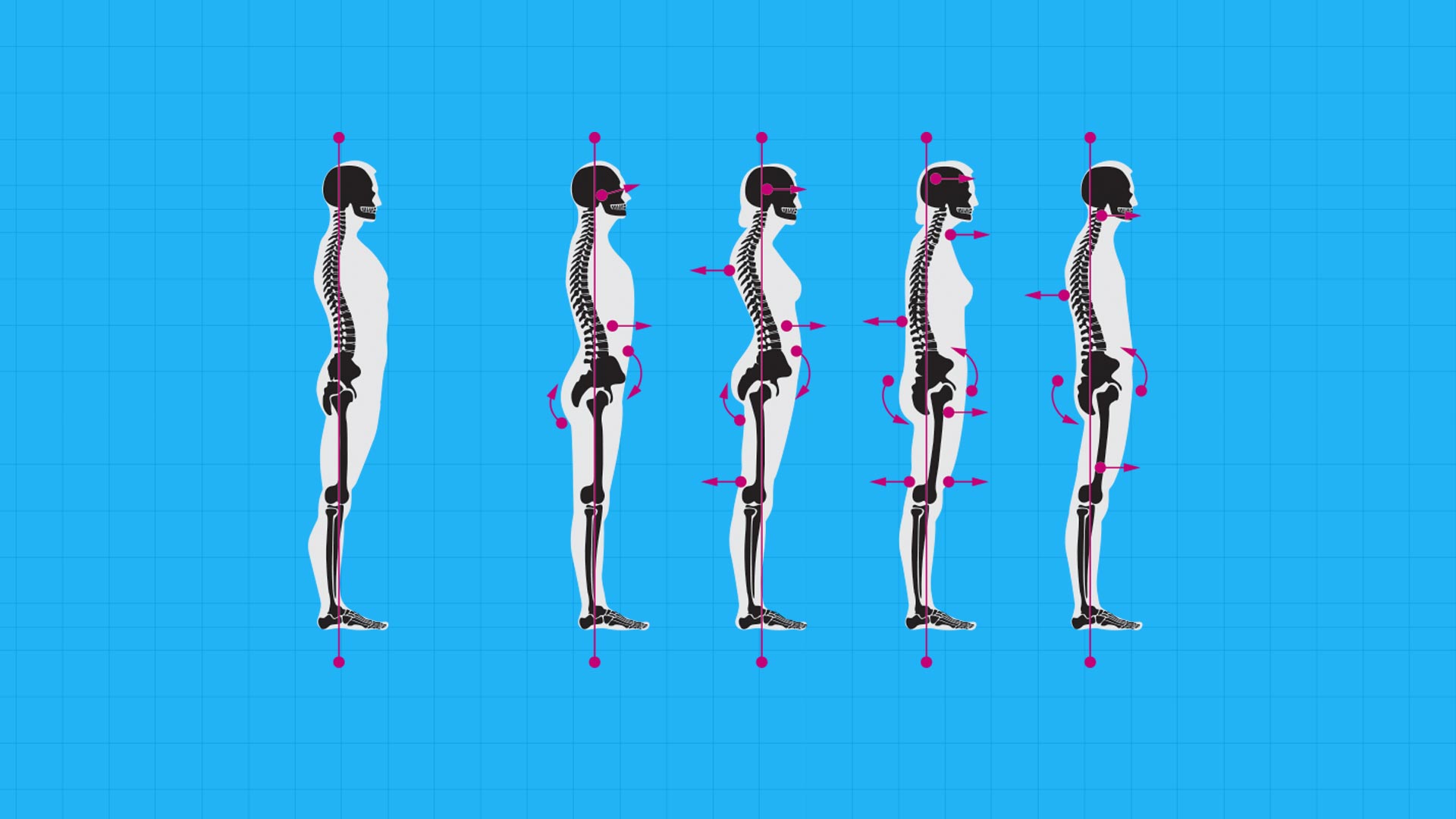 Nieuw Hoe verbeter ik mijn houding? Lees het hier! | FIT.nl RB-85