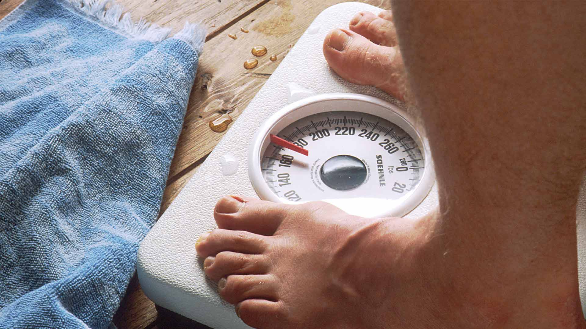 Obesitas